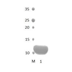 PPP1R9A PDZ Domain