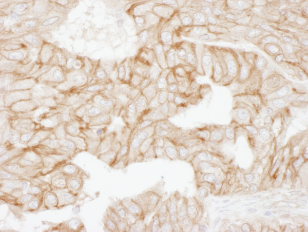 Anti-Alpha-Adducin