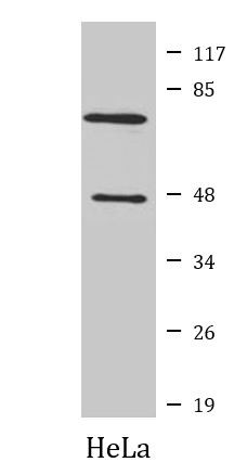 Anti-Component C1s (FL+ Heavy chain)