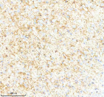 Anti-SYNPR / Synaptoporin