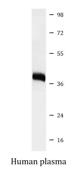 Anti-ApoL1 / Apolipoprotein L1