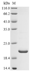 Carbamoyl-phosphate synthase [ammonia], mitochondrial (CPS1),partial, human, recombinant