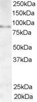 Anti-AKAP3 / SOB1, C-terminal