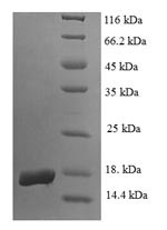 Egl nine homolog 2 (EGLN2), partial, human, recombinant
