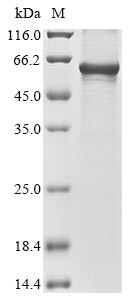 Wilms tumor protein homolog (Wt1), mouse, recombinant