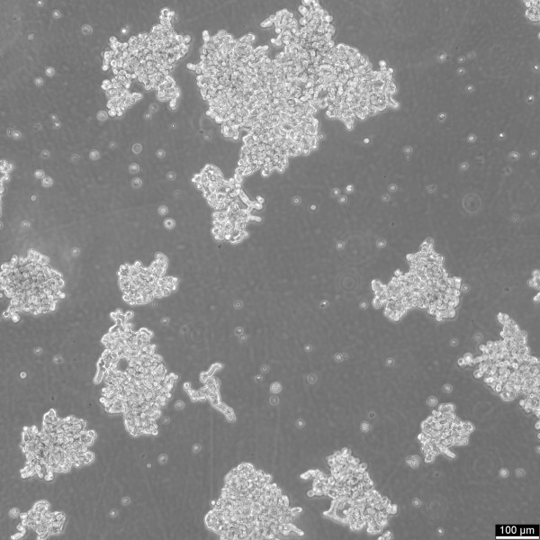 WERI-Rb-1 Cells