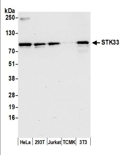 Anti-STK33