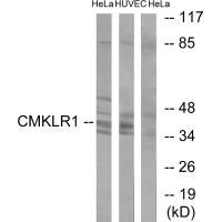 Anti-CMKLR1