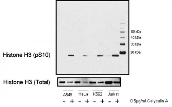 Anti-phospho-Histone H3 (Ser10)