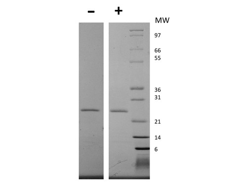 EBI-3