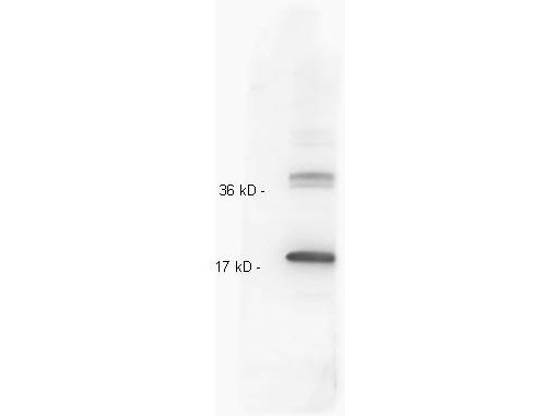 Anti-Interleukin-10 (IL-10) (human)