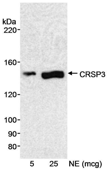 Anti-CRSP3