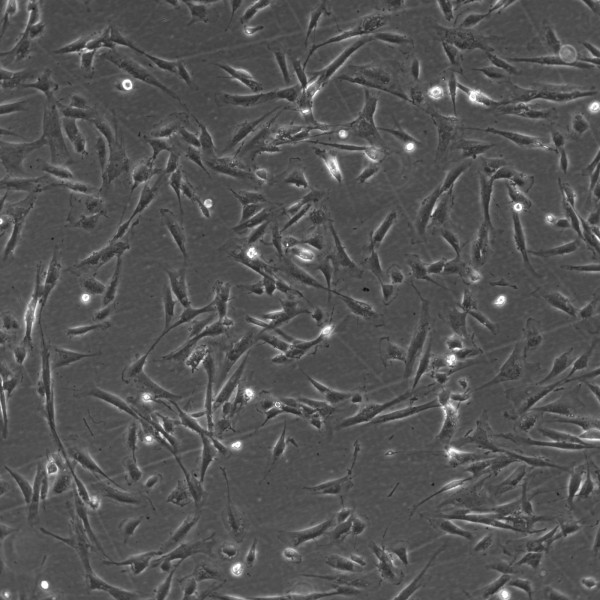 Wilms10T Cells