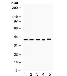 Anti-DMRT1