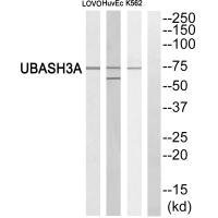 Anti-UBASH3A