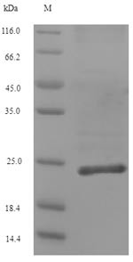 Collagen alpha-1 (XII) chain (COL12A1), partial, human, recombinant
