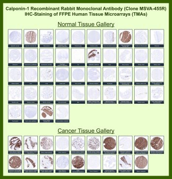 Anti-Calponin 1 / CNN1, clone MSVA-455R