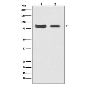 Anti-Mitofusin 2 / MFN2, clone AOCA-13