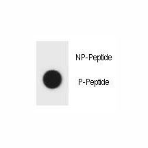 Anti-phospho-TSC1 (Tyr304)