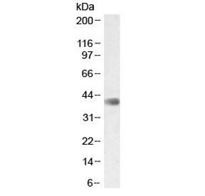 Anti-CDK9