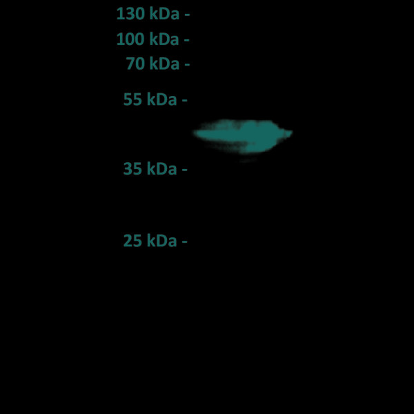 Anti-FOLR1 antibody(18A3), IgG1 Chimeric mAb