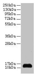 Anti-SNRPD2