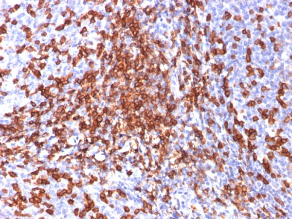Anti-CD44 / HCAM (Cancer Stem Cell Marker), clone 156-3C11