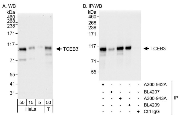 Anti-TCEB3