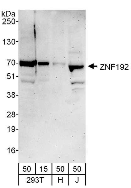 Anti-ZNF192