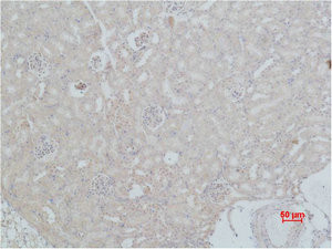 Anti-HSPA8