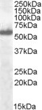 Anti-IRF5, C-terminal