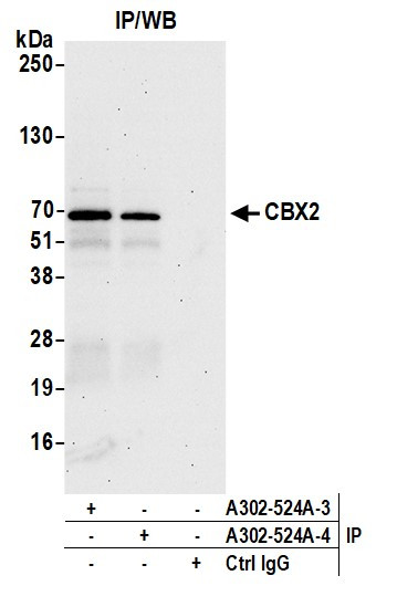 Anti-CBX2