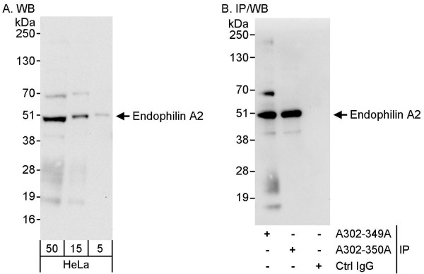 Anti-Endophilin A2