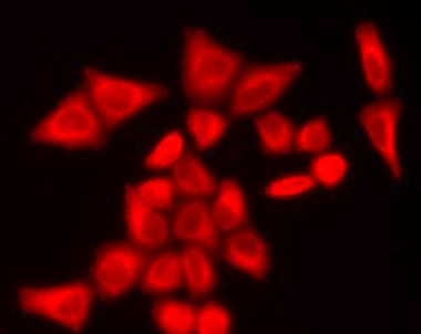 Anti-ADSL / Adenylosuccinate Lyase