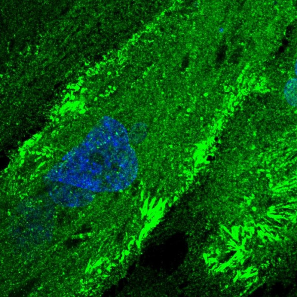 Anti-FMN2