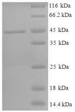 11-beta-Hydroxysteroid dehydrogenase 1 (HSD11B1), partial, human, recombinant