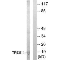 Anti-TP53I11