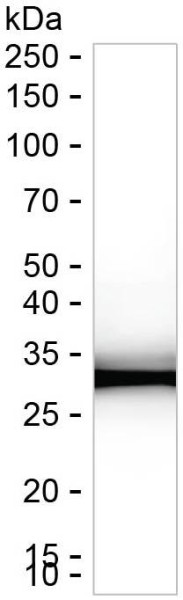Anti-Sulfotransferase 2A1