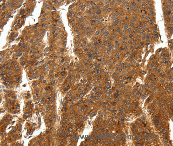 Anti-SCN11A