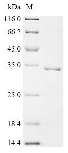 Aluminum-activated malate transporter 1 (ALMT1), partial, recombinant Triticum aestivum
