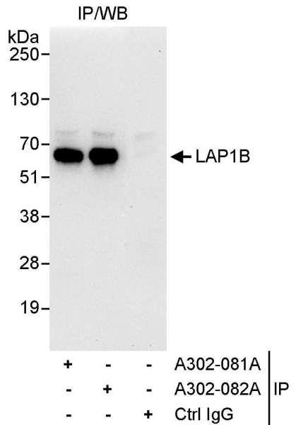 Anti-LAP1B