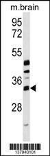 Anti-METTL6, ID (METTL6, Methyltransferase-like protein 6)