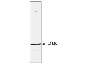 Anti-Hsp27 (Heat Shock Protein 27), clone G3.1