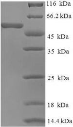 Spike glycoprotein (S), partial, human coronavirus OC43, recombinant
