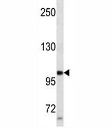 Anti-Progesterone Receptor, clone 312CT8.2.1.6