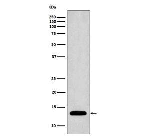 Anti-Profilin 1, clone ABCD-16