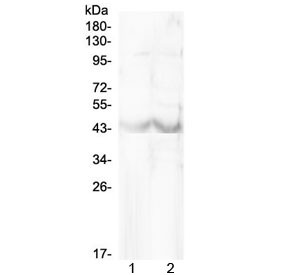 Anti-Chi3l1 / Chitinase-3-like protein 1