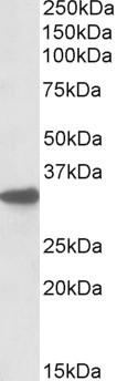 Anti-CYB5R3 / Dia 1, C-terminal