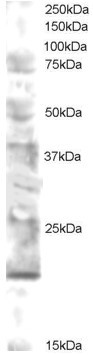 Anti-UEV2V2 / MMS2, N-terminal