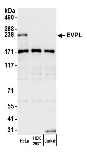 Anti-EVPL